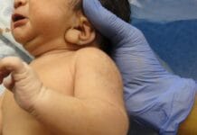 Epidural Shortages: The Quiet Maternity Crisis No One Planned For